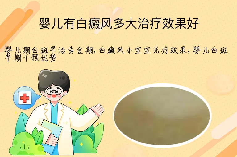 婴儿有白癜风多大治疗效果好