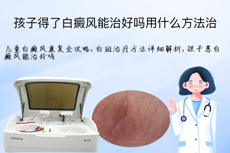 孩子得了白癜风能治好吗用什么方法治