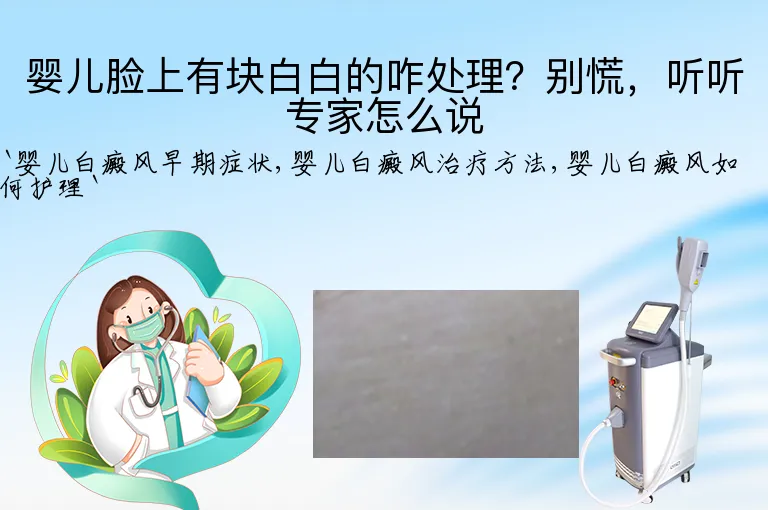 婴儿脸上有块白白的咋处理？别慌，听听专家怎么说