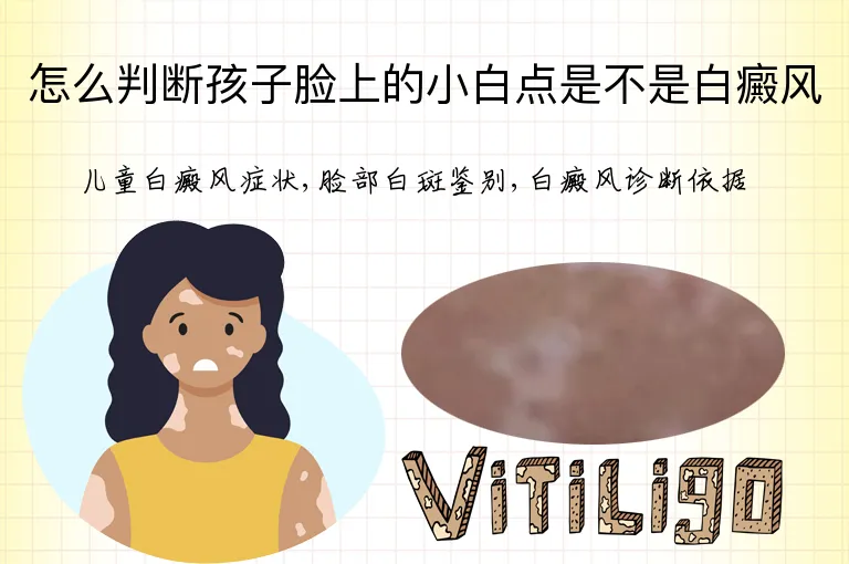 怎么判断孩子脸上的小白点是不是白癜风