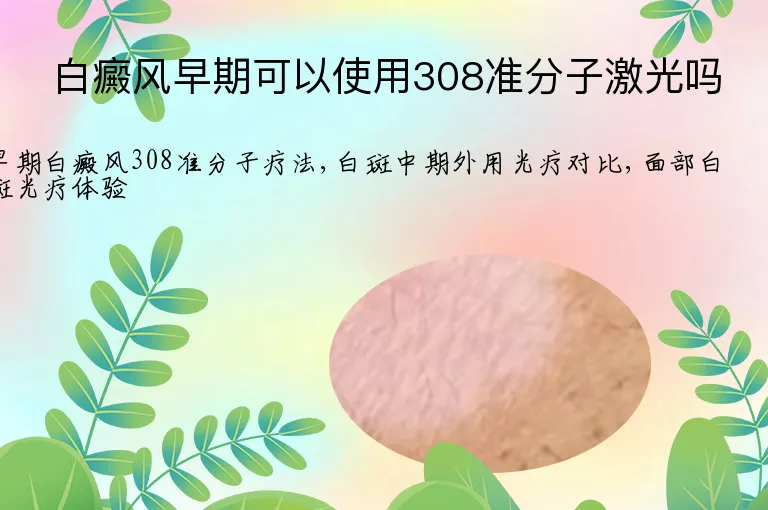 白癜风早期可以使用308准分子激光吗