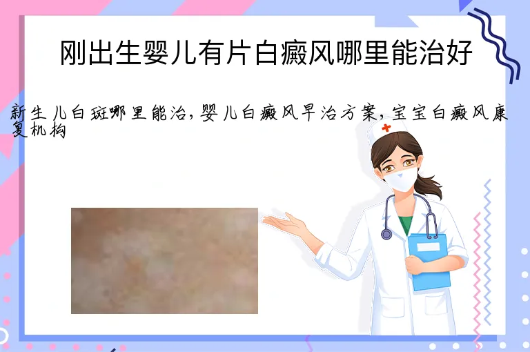 刚出生婴儿有片白癜风哪里能治好