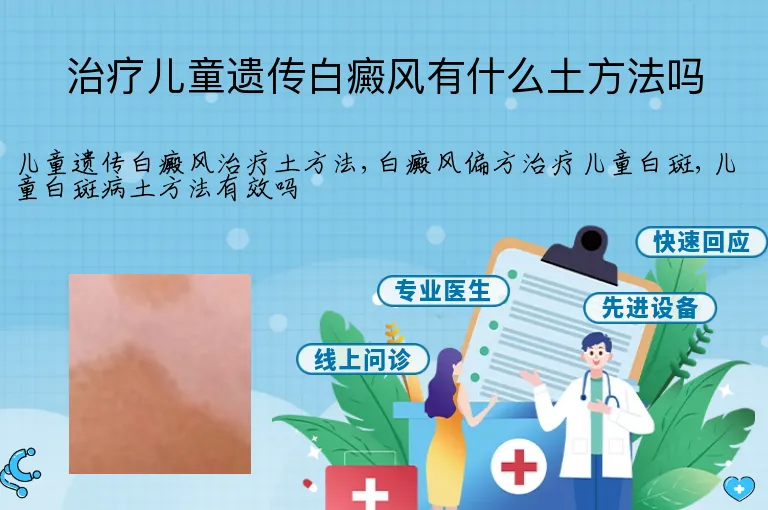 治疗儿童遗传白癜风有什么土方法吗