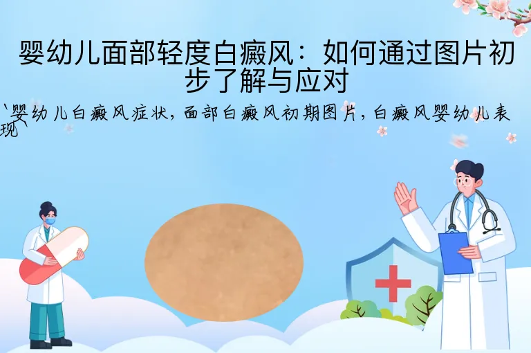 婴幼儿面部轻度白癜风：如何通过图片初步了解与应对