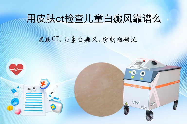 用皮肤ct检查儿童白癜风靠谱么