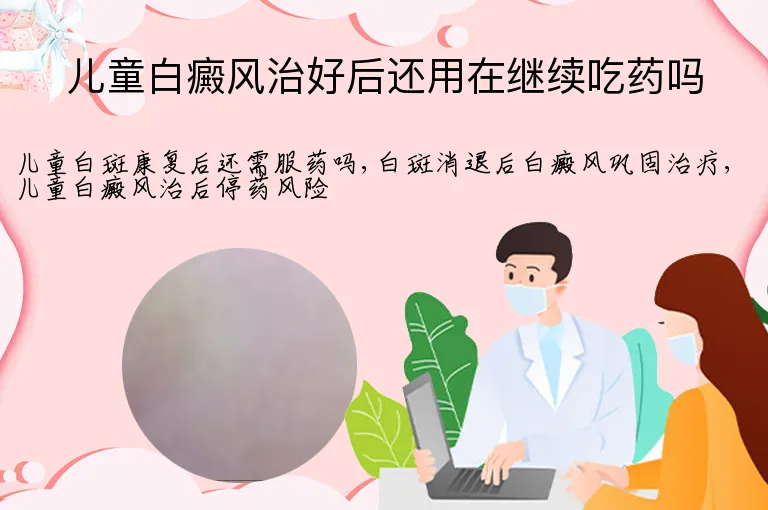 儿童白癜风治好后还用在继续吃药吗