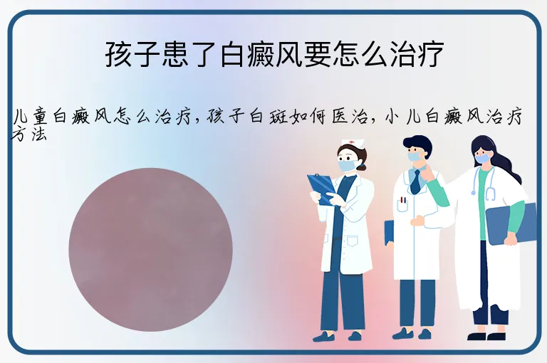 孩子患了白癜风要怎么治疗