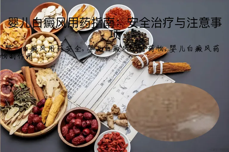 婴儿白癜风用药指南：安全治疗与注意事项