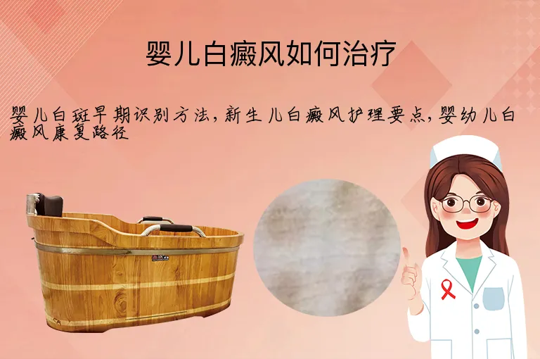 婴儿白癜风如何治疗
