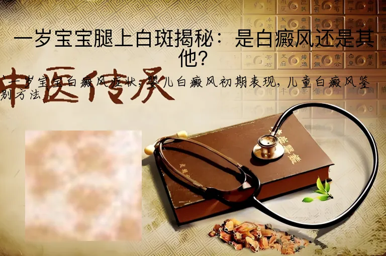 一岁宝宝腿上白斑揭秘：是白癜风还是其他？