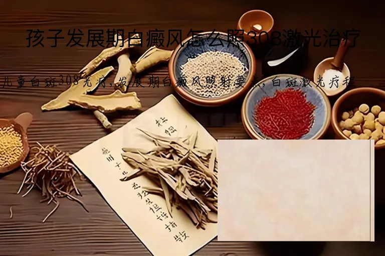 孩子发展期白癜风怎么照308激光治疗