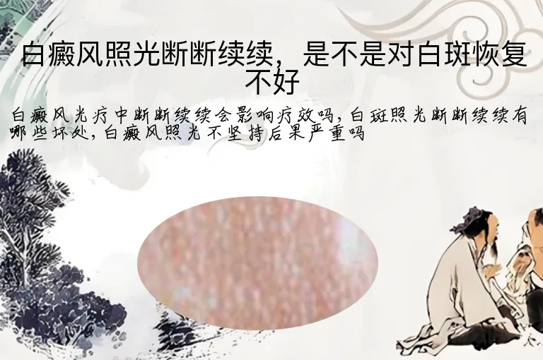白癜风照光断断续续，是不是对白斑恢复不好
