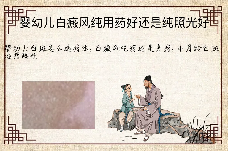 婴幼儿白癜风纯用药好还是纯照光好