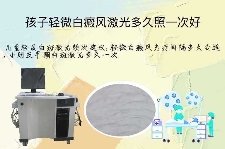 孩子轻微白癜风激光多久照一次好