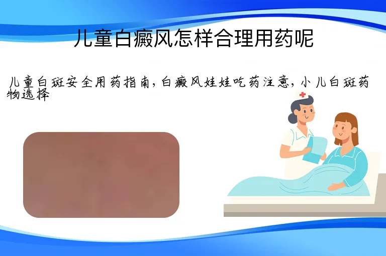 儿童白癜风怎样合理用药呢