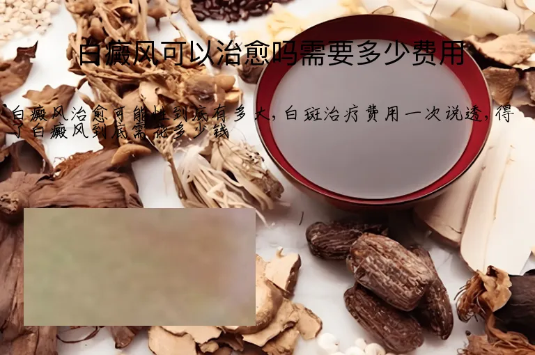 白癜风可以治愈吗需要多少费用
