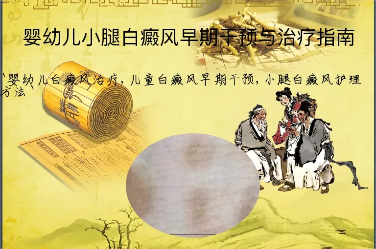 婴幼儿小腿白癜风早期干预与治疗指南