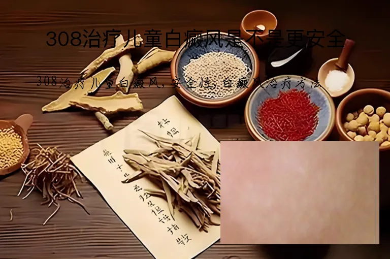 308治疗儿童白癜风是不是更安全