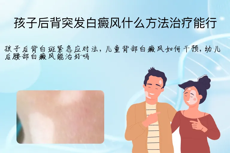 孩子后背突发白癜风什么方法治疗能行
