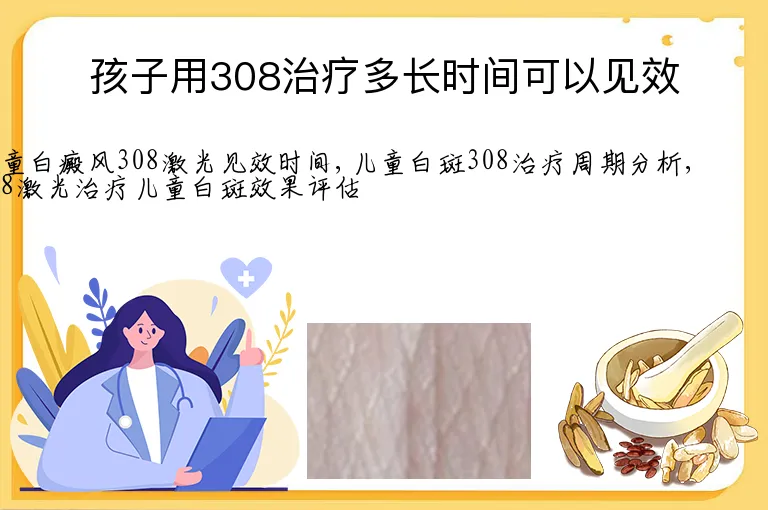 孩子用308治疗多长时间可以见效