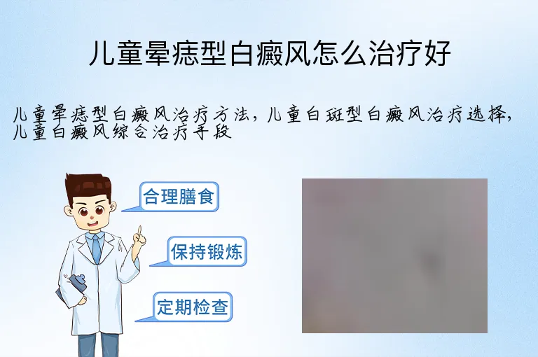 儿童晕痣型白癜风怎么治疗好
