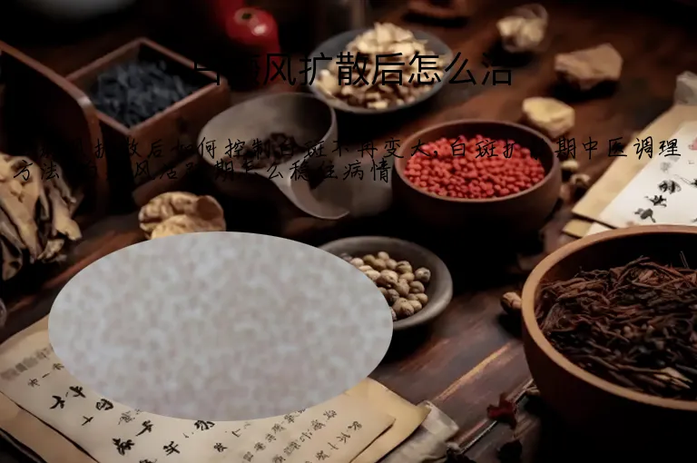 白癜风扩散后怎么治