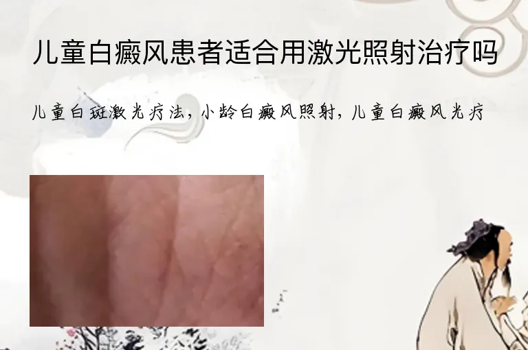 儿童白癜风患者适合用激光照射治疗吗