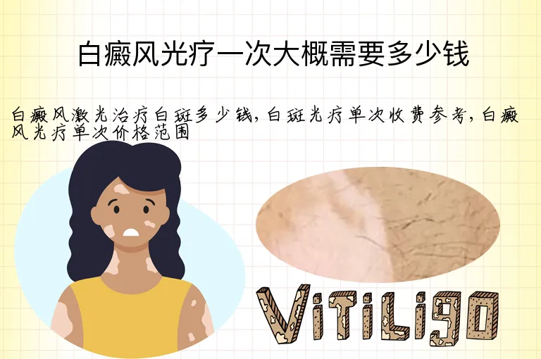 白癜风光疗一次大概需要多少钱