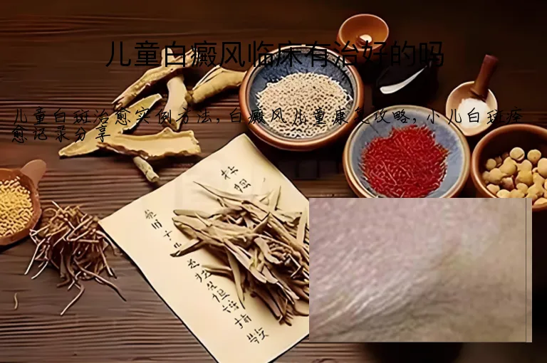 儿童白癜风临床有治好的吗