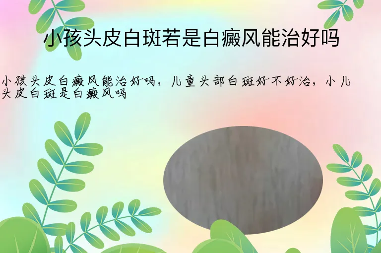 小孩头皮白斑若是白癜风能治好吗