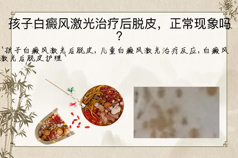 孩子白癜风激光治疗后脱皮，正常现象吗？