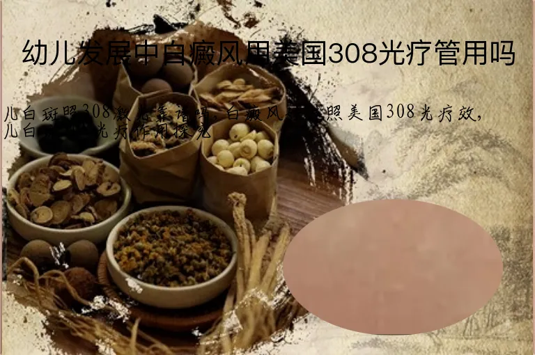 幼儿发展中白癜风用美国308光疗管用吗