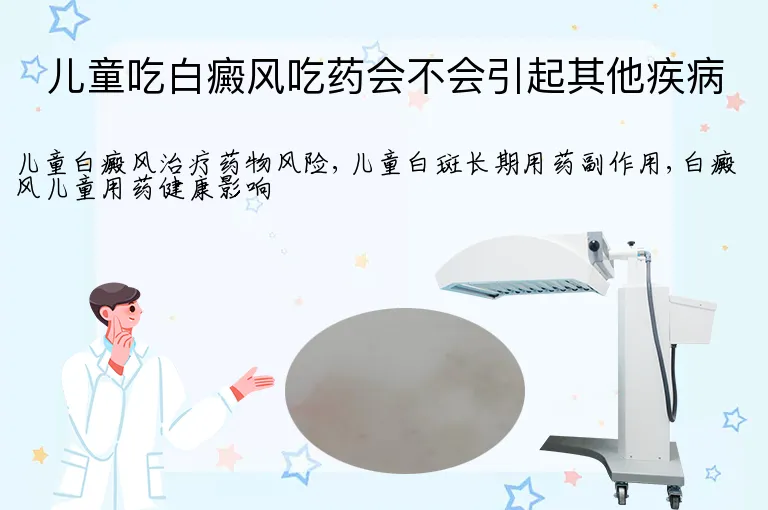 儿童吃白癜风吃药会不会引起其他疾病