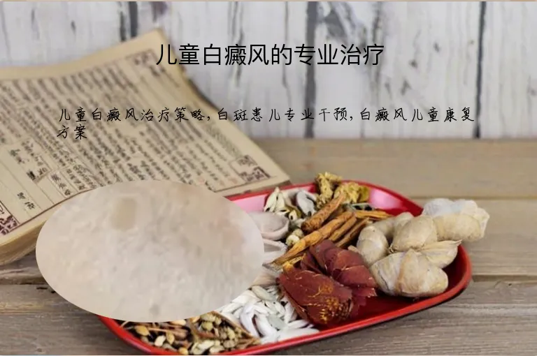 儿童白癜风的专业治疗