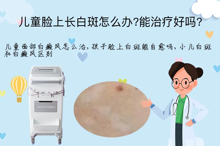 儿童脸上长白斑怎么办?能治疗好吗?