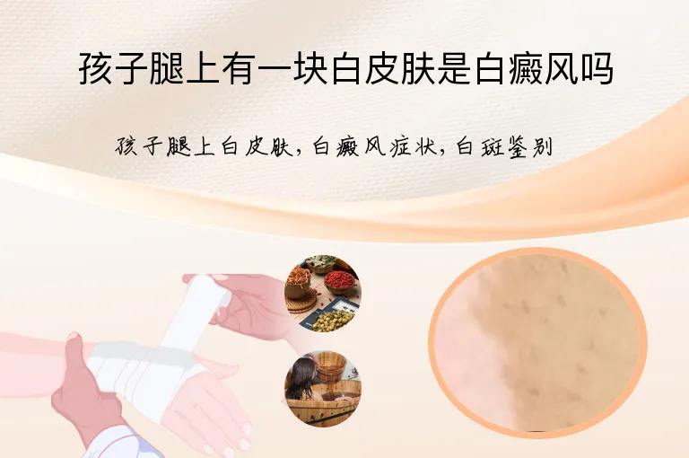 孩子腿上有一块白皮肤是白癜风吗