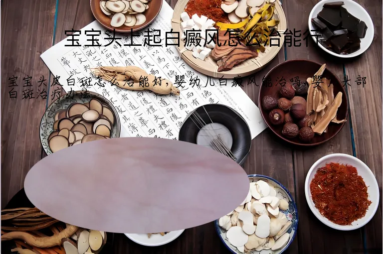 宝宝头上起白癜风怎么治能行