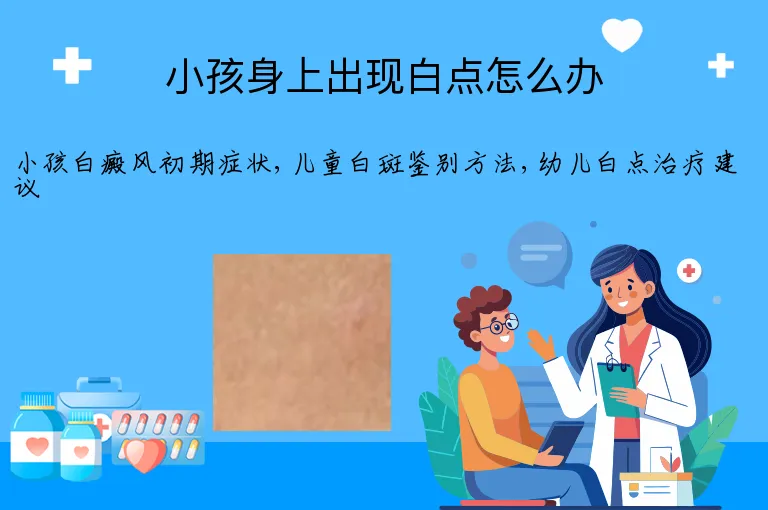 小孩身上出现白点怎么办