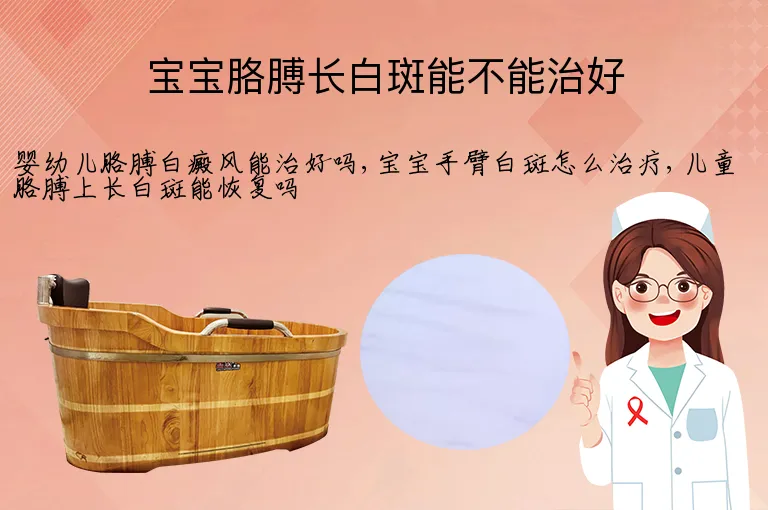宝宝胳膊长白斑能不能治好