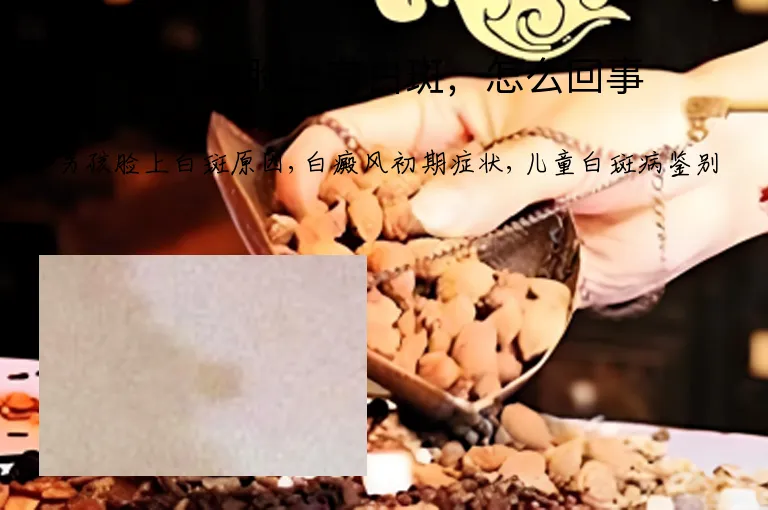 小男孩脸上有白斑，怎么回事