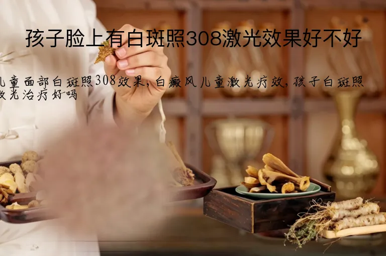 孩子脸上有白斑照308激光效果好不好