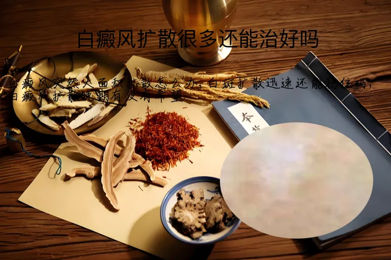 白癜风扩散很多还能治好吗