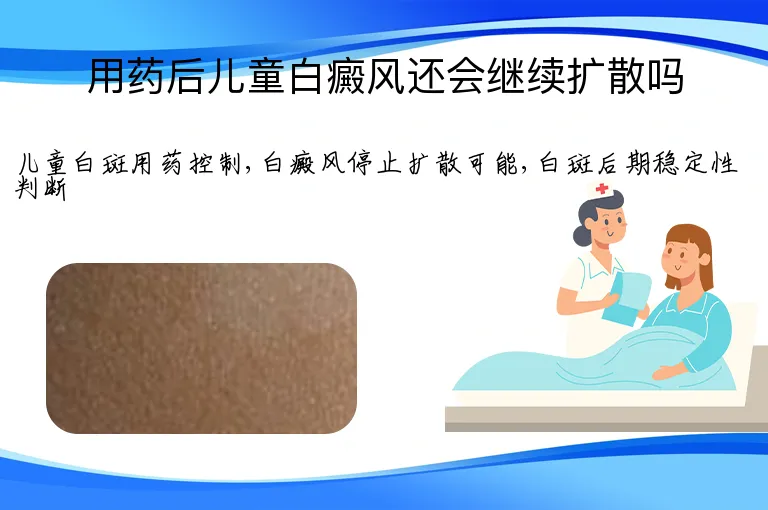 用药后儿童白癜风还会继续扩散吗