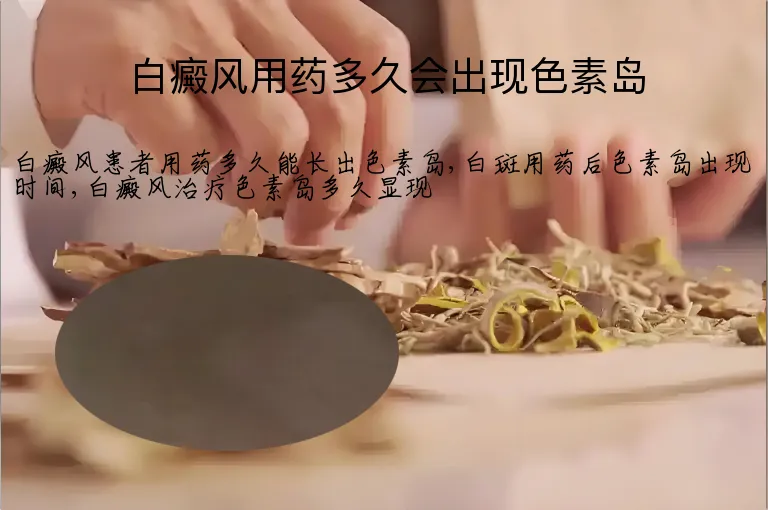 白癜风用药多久会出现色素岛