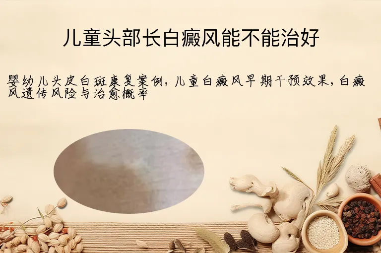 儿童头部长白癜风能不能治好