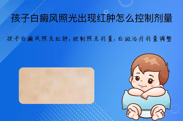 孩子白癜风照光出现红肿怎么控制剂量