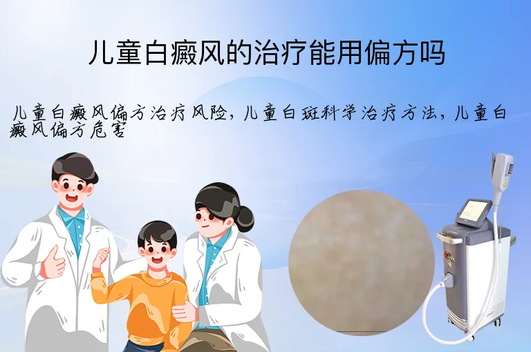 儿童白癜风的治疗能用偏方吗