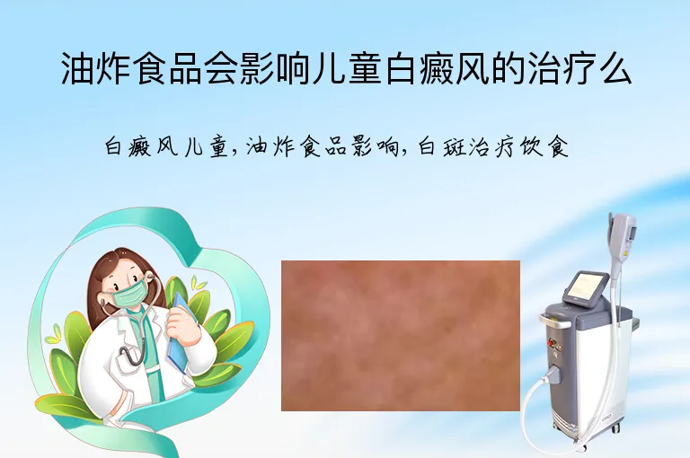 油炸食品会影响儿童白癜风的治疗么