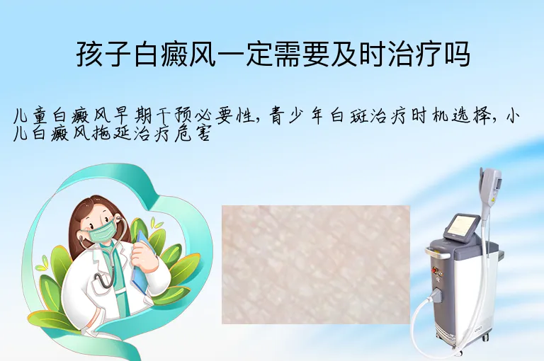 孩子白癜风一定需要及时治疗吗