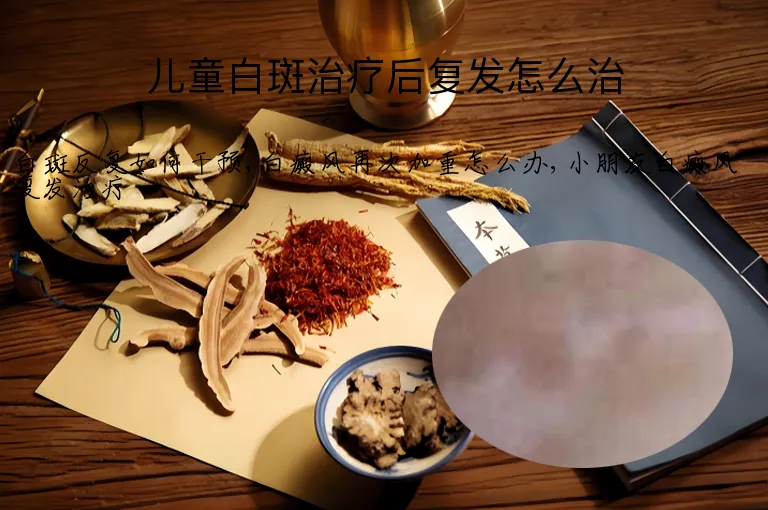 儿童白斑治疗后复发怎么治